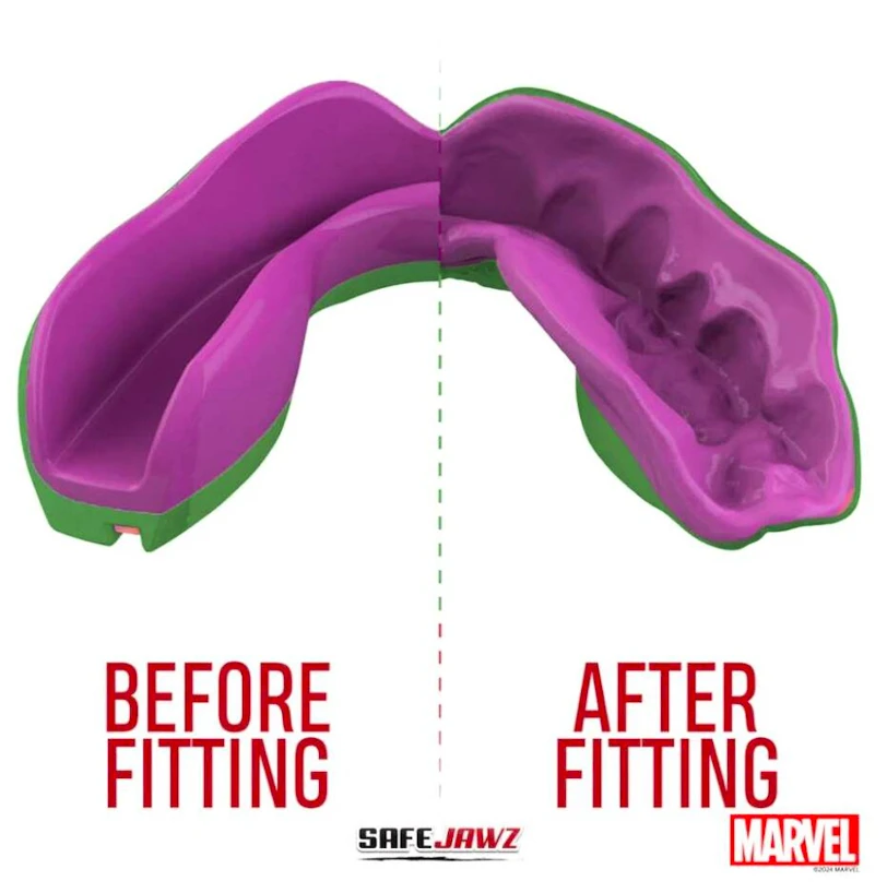 Gebitsbeschermer SAFEJAWZ  Marvel The Hulk Senior
